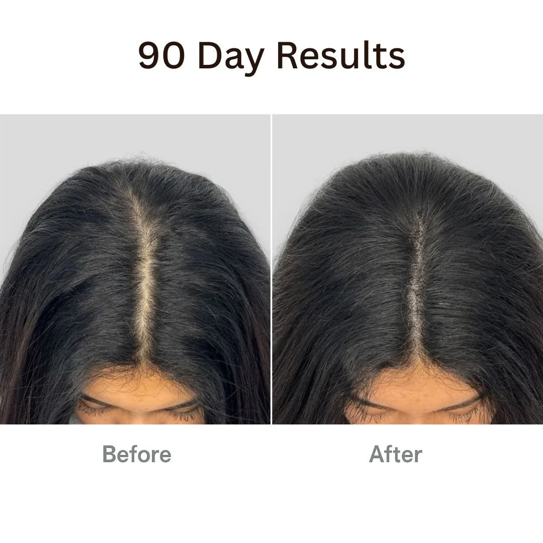Unlock Your Hair's Potential with the Therabrush™ + Hair Tonic Natural Growth Kit