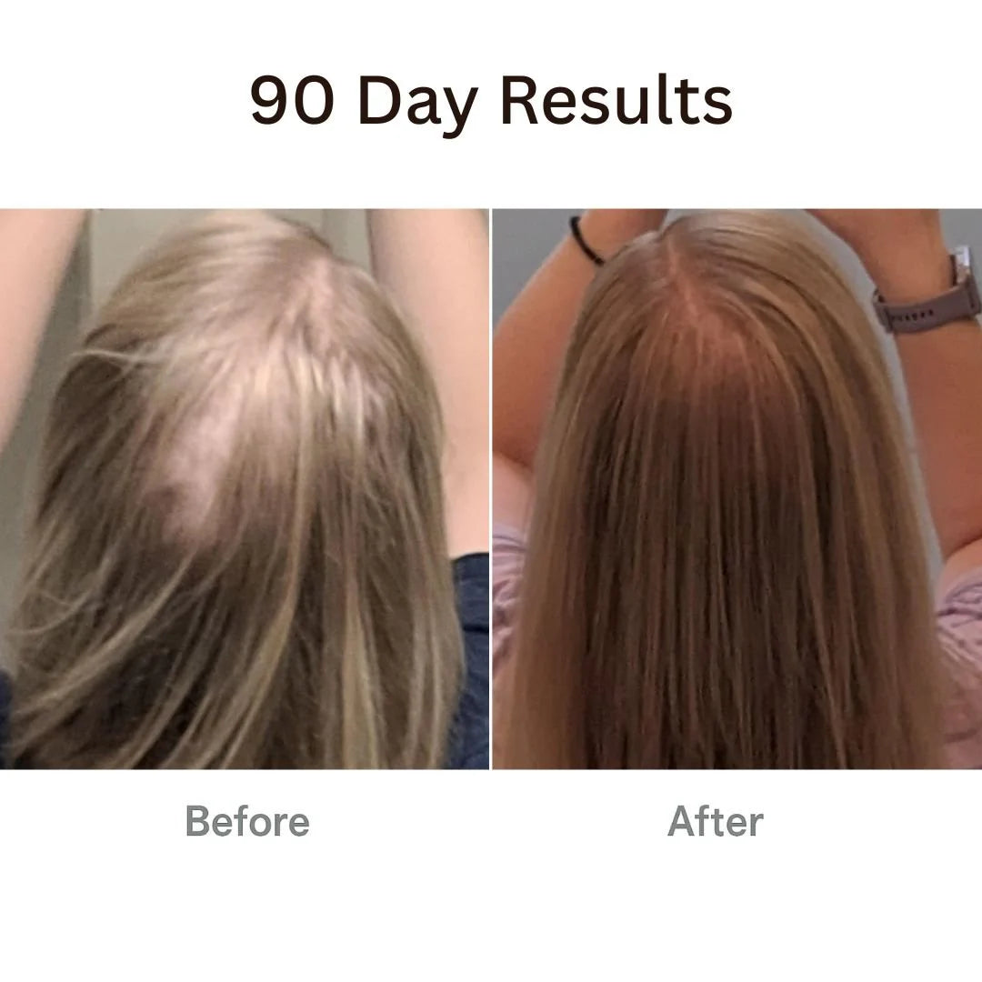 Unlock Your Hair's Potential with the Therabrush™ + Hair Tonic Natural Growth Kit