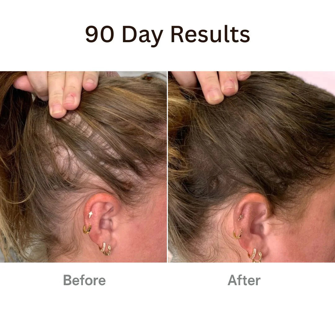 Unlock Your Hair's Potential with the Therabrush™ + Hair Tonic Natural Growth Kit