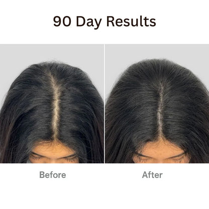 Unlock Your Hair's Potential with the Therabrush™ + Hair Tonic Natural Growth Kit