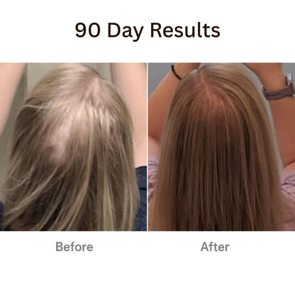 Unlock Your Hair's Potential with the Therabrush™ + Hair Tonic Natural Growth Kit